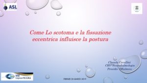 Come lo scotoma e la fissazione eccentrica influisce la postura